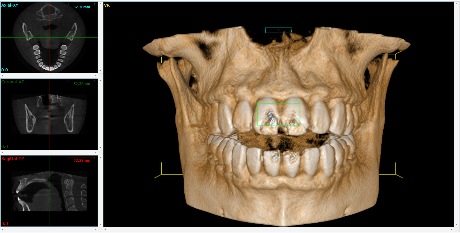Cone Beam 3D Imaging